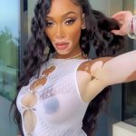 Winnie Harlow