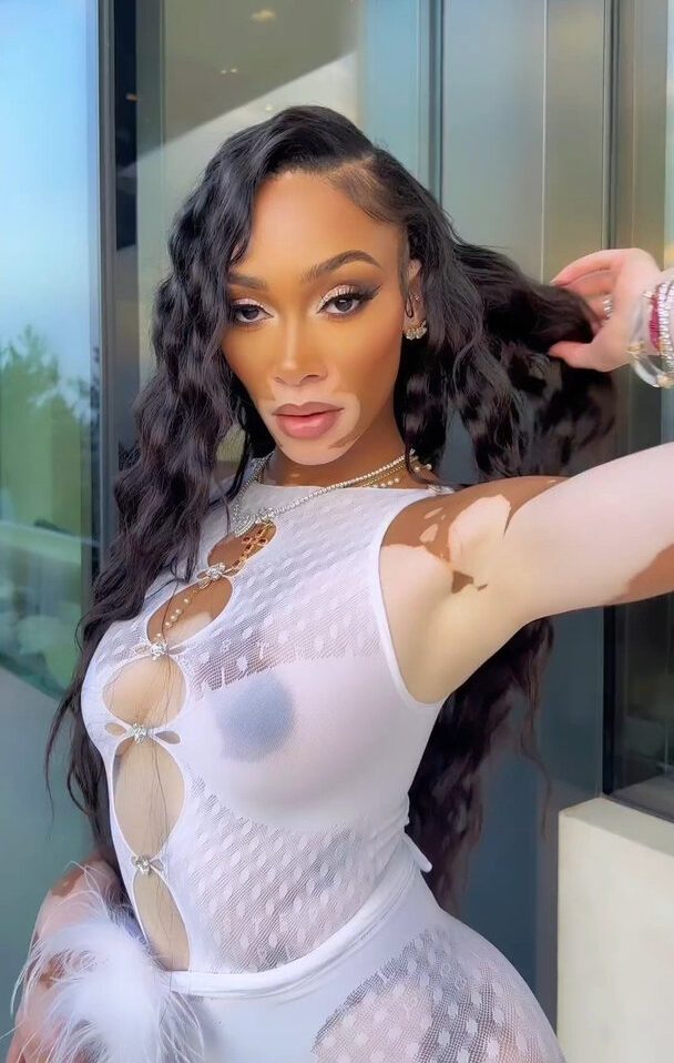 Winnie Harlow